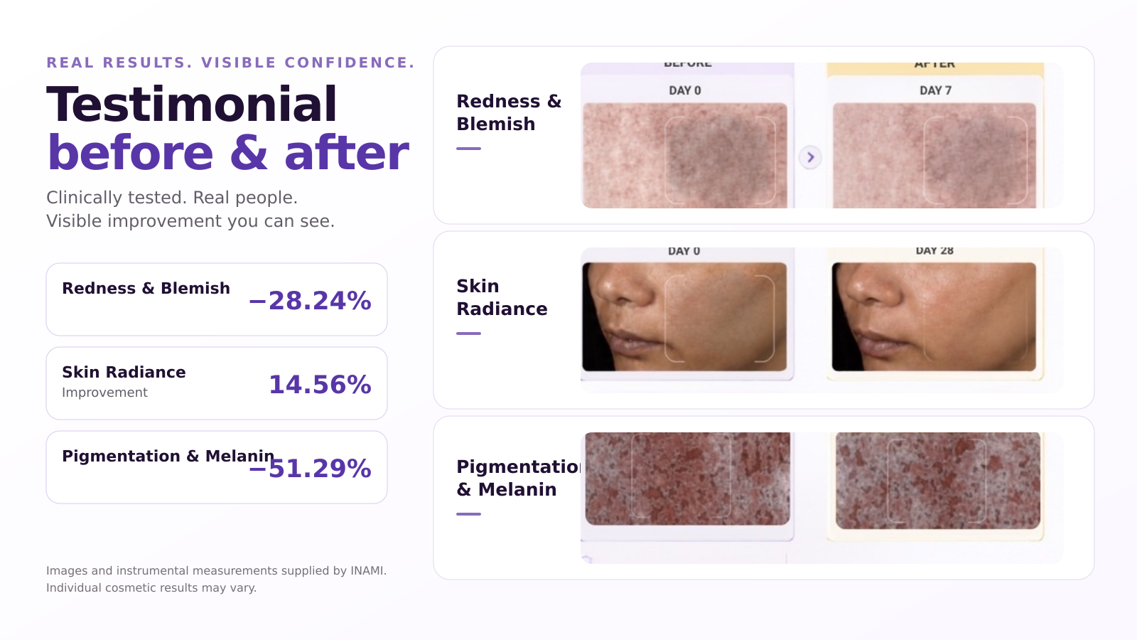 INAMI testimonial before and after results showing changes in redness and blemishes, skin radiance, pigmentation and melanin