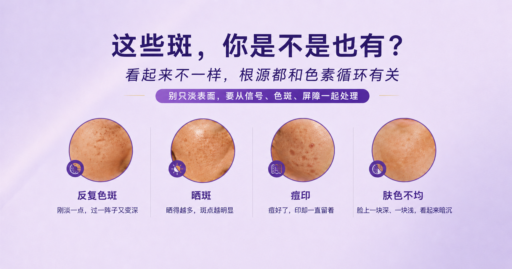 Different pigmentation signs including recurring patches, sun spots, post-acne marks and uneven tone
